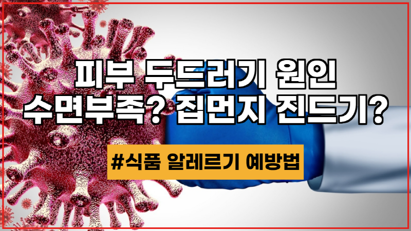  두드러기 발생 원인 수면부족 집먼지 진드기 식품 알레르기