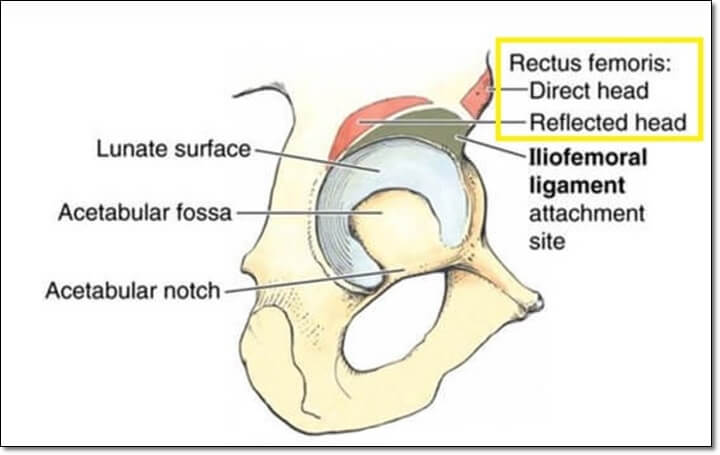 대퇴직근의 기시점을 나타낸 골반 그림