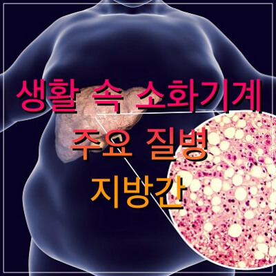  지방간 증상 및 지방간 치료방법