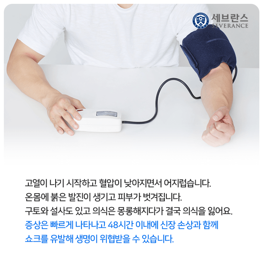 일본 감염병 연쇄구균 독성 쇼크 증후군 치사율 증상 예방법