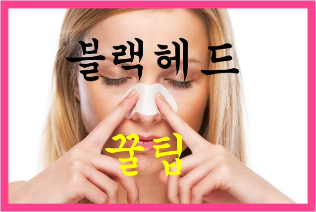  블랙헤드 제거 방법 무엇이 있을까?