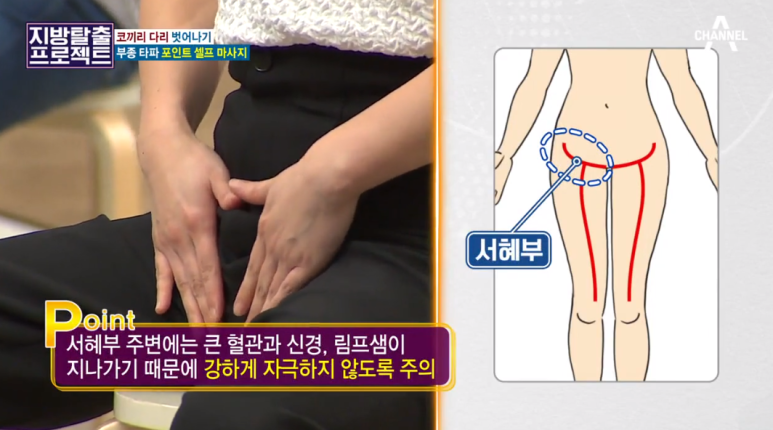 다리 부종 스트레칭 10분만에 다리부기, 하체부종