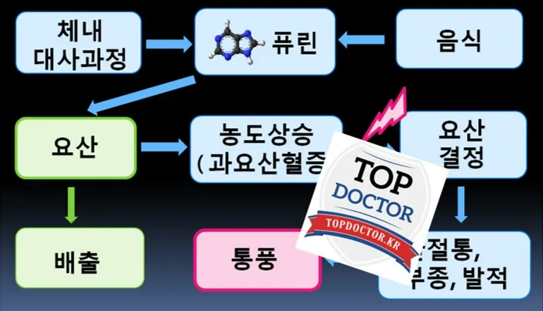 통풍에 좋은 음식