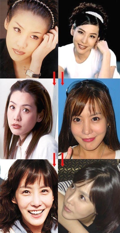김정은 얼굴 변천사