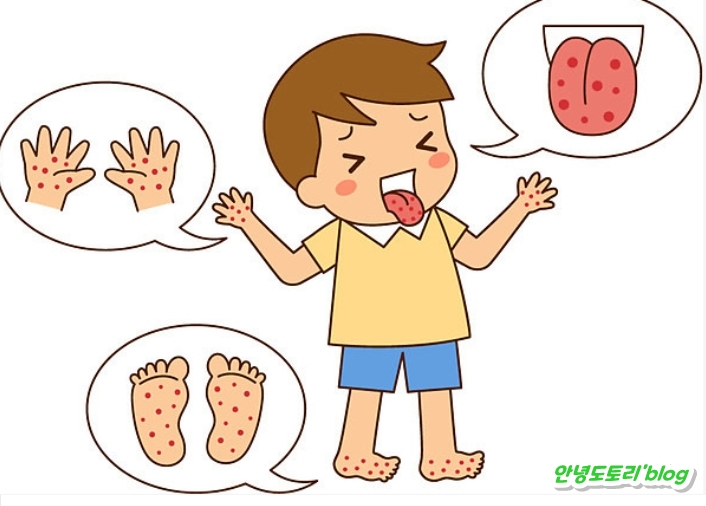  대상포진 초기증상