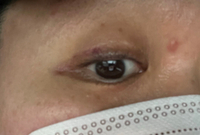 아이라인반영구 18