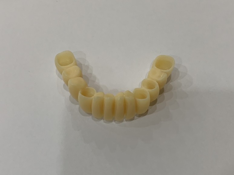 치과 3d 프린터 안양치과 추천, 3D 3