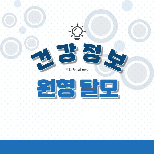 건강-정보-원형-탈모-라고-쓰여진-사진