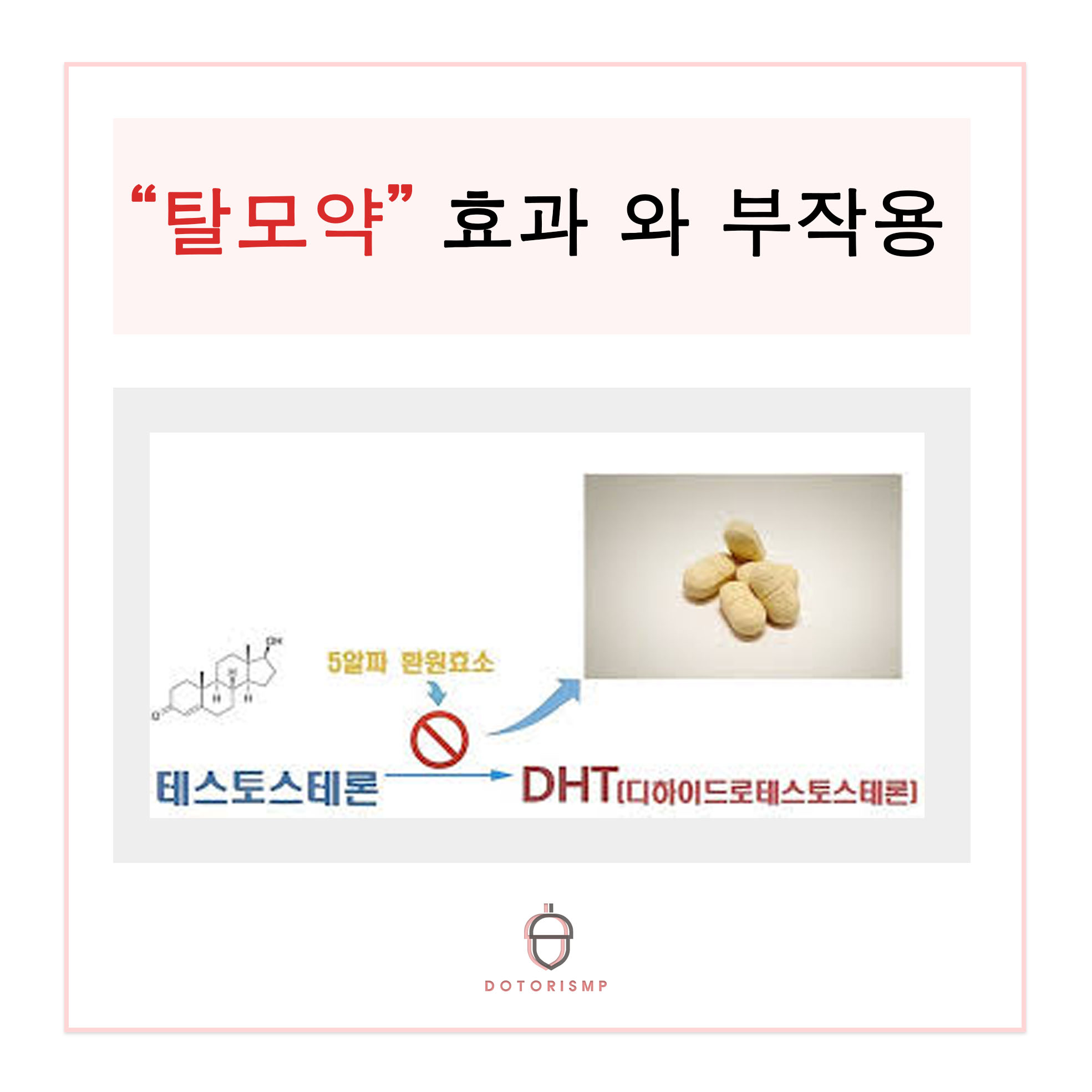  탈모약 효과와 부작용