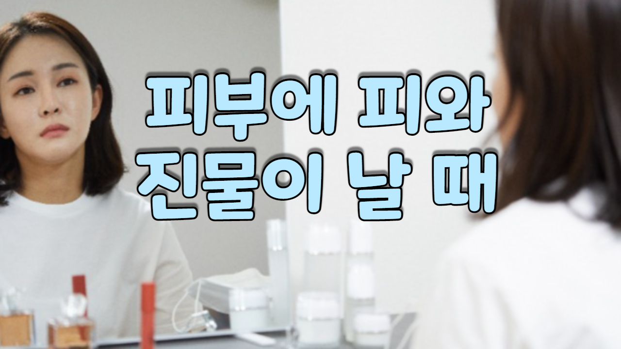  피부에서 피와 진물이 날 때