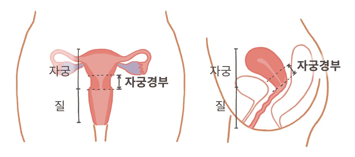 “자궁경부암” 예방 주사 “가다실” “4가 9가 비교” “남자”