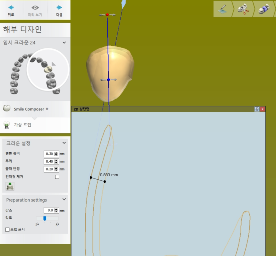 preparation settings 설정