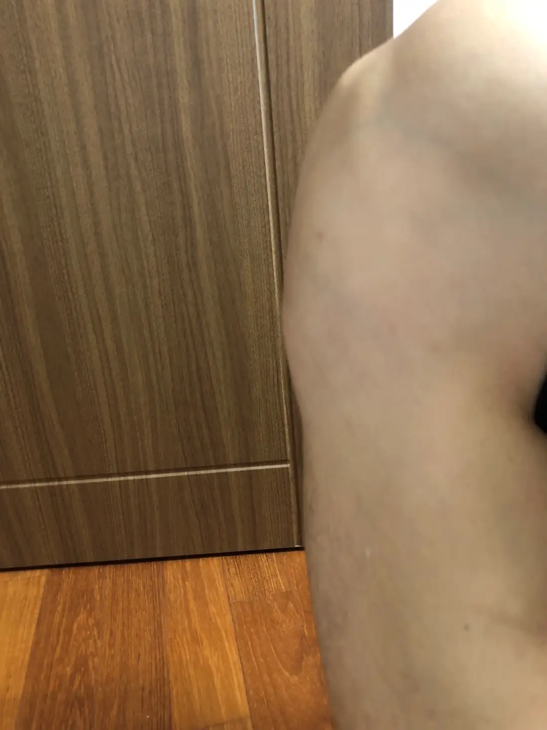 오스굿씨 병 오른쪽 무릎