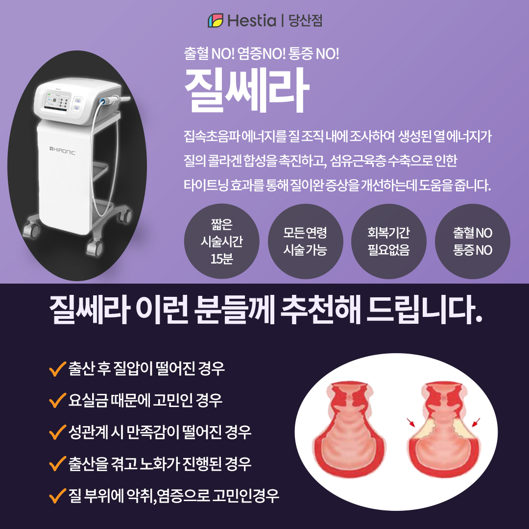 질쎄라란?