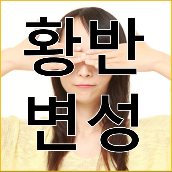  황반변성 증상과 원인 그리고 예방법과 자가테스트