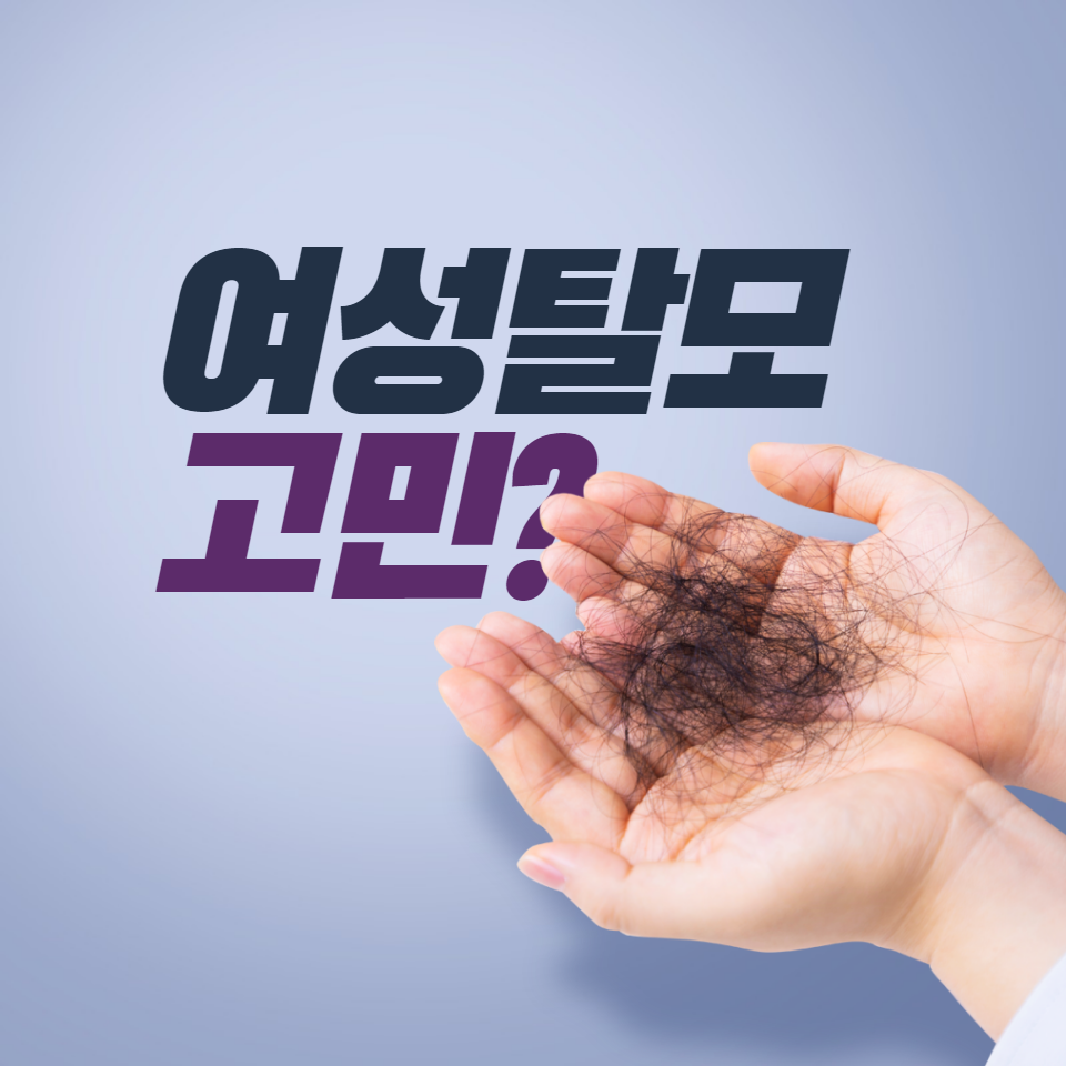  여성탈모 고민, 예방과 치료방법 알아보기