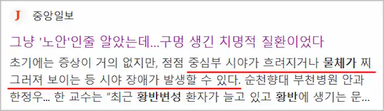 황반변성 증상 기사 이미지