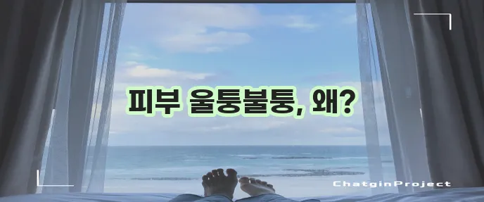 모공 각화증 원인 다섯 가지를 알아봅시다!