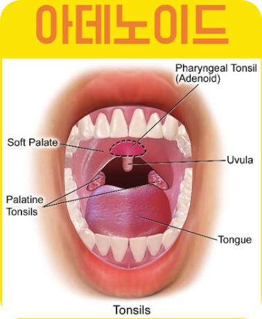 아데노바이러스13