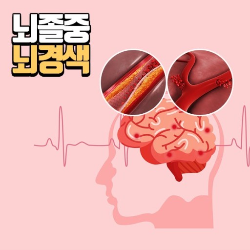 뇌졸중 전조증상과 체크리스트 및 예방과 치료