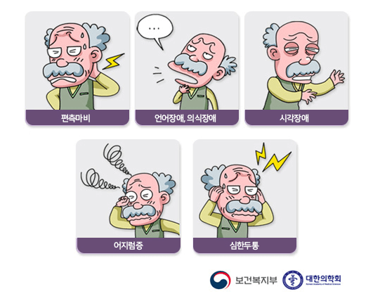 편마비 ,  언어 장애,  의식 장애,  블라인드 & # 44;  현기증 ,  심한 두통의 예