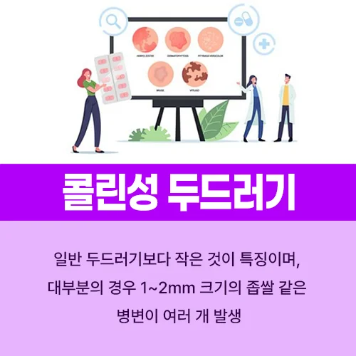 콜린성 두드러기