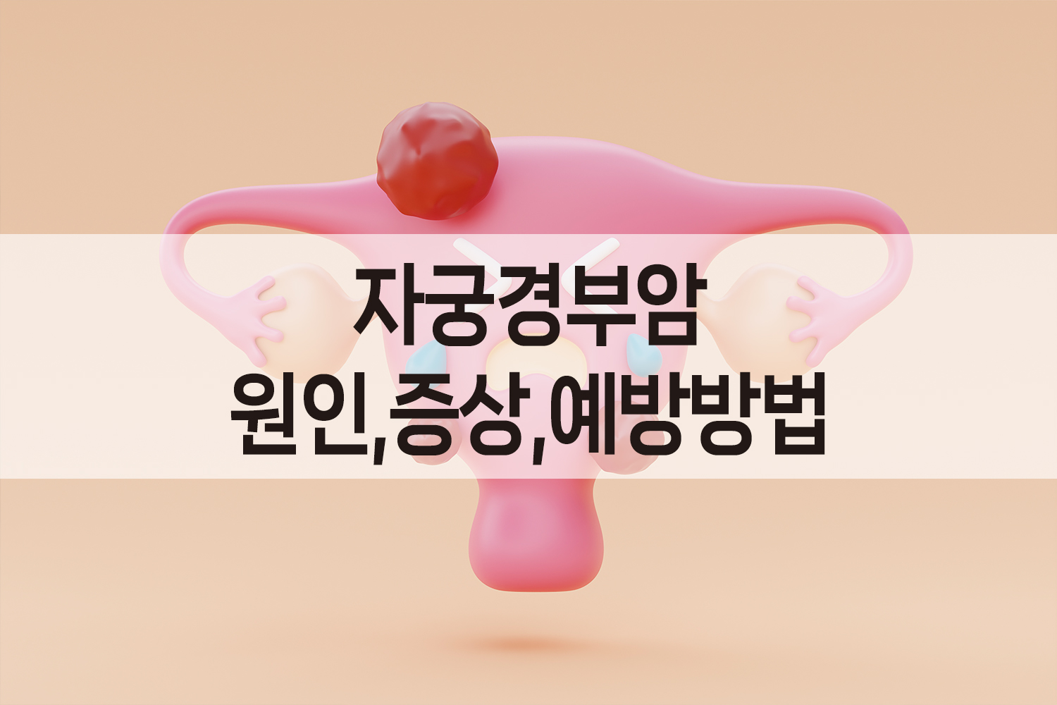 자궁경부암 원인,증상,예방방법