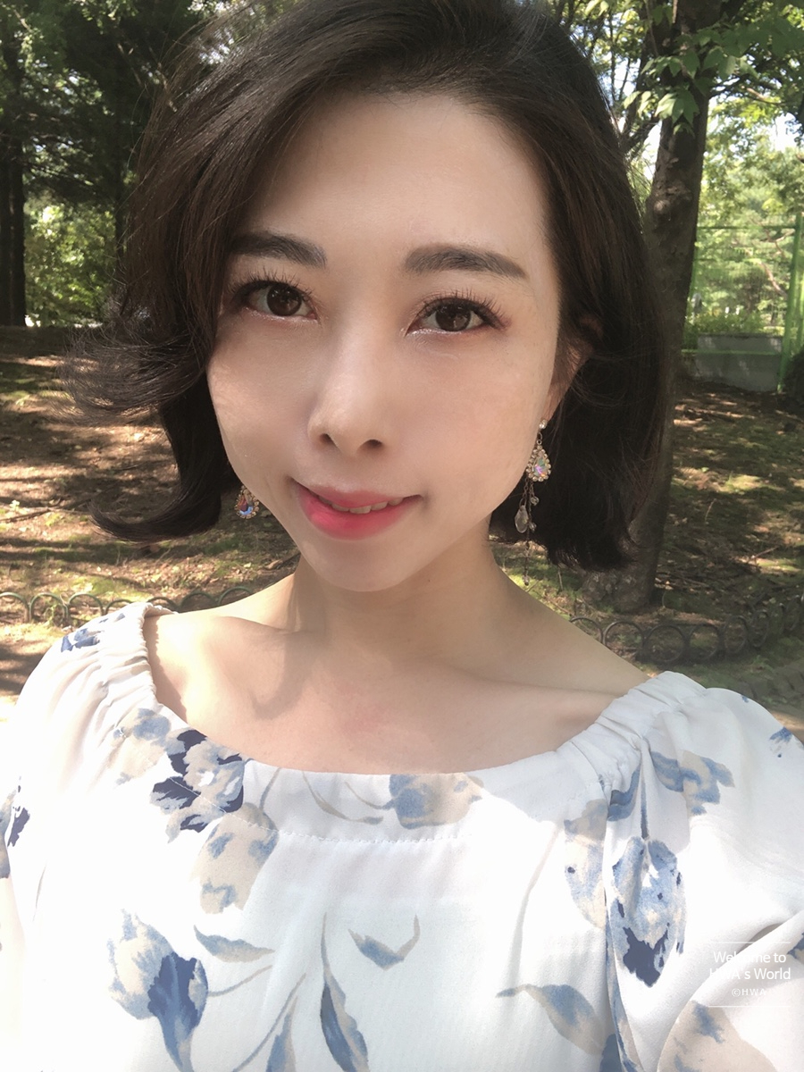 콧볼 축소 비용 [강남/보톡스] 콧볼축소주사-후기 21