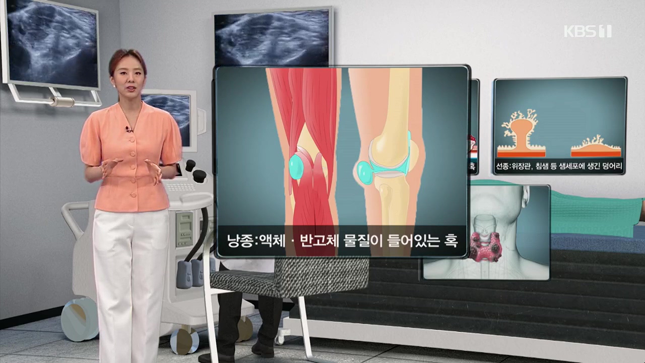 생로병사의 비밀.E870.230532p.H264-F1RST.mp4_20230605_195524.449.jpg