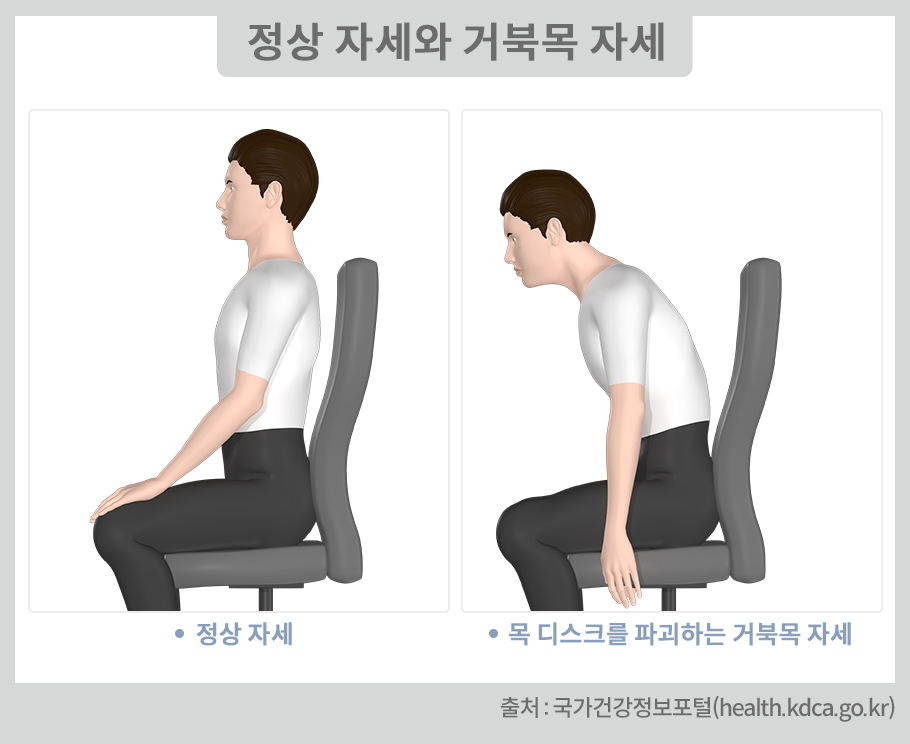 거북목 자세와 올바른 자세 비교사진