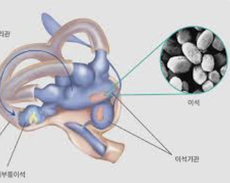 어지러움증의 원인