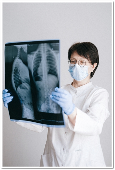 의사가 폐 엑스레이 사진을 들고 보고있다