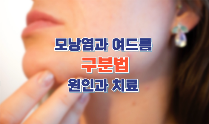 모낭염과-여드름-차이점과-치료법