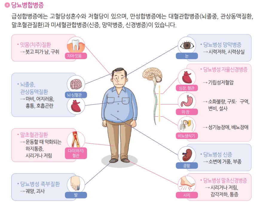 당뇨병 합병증