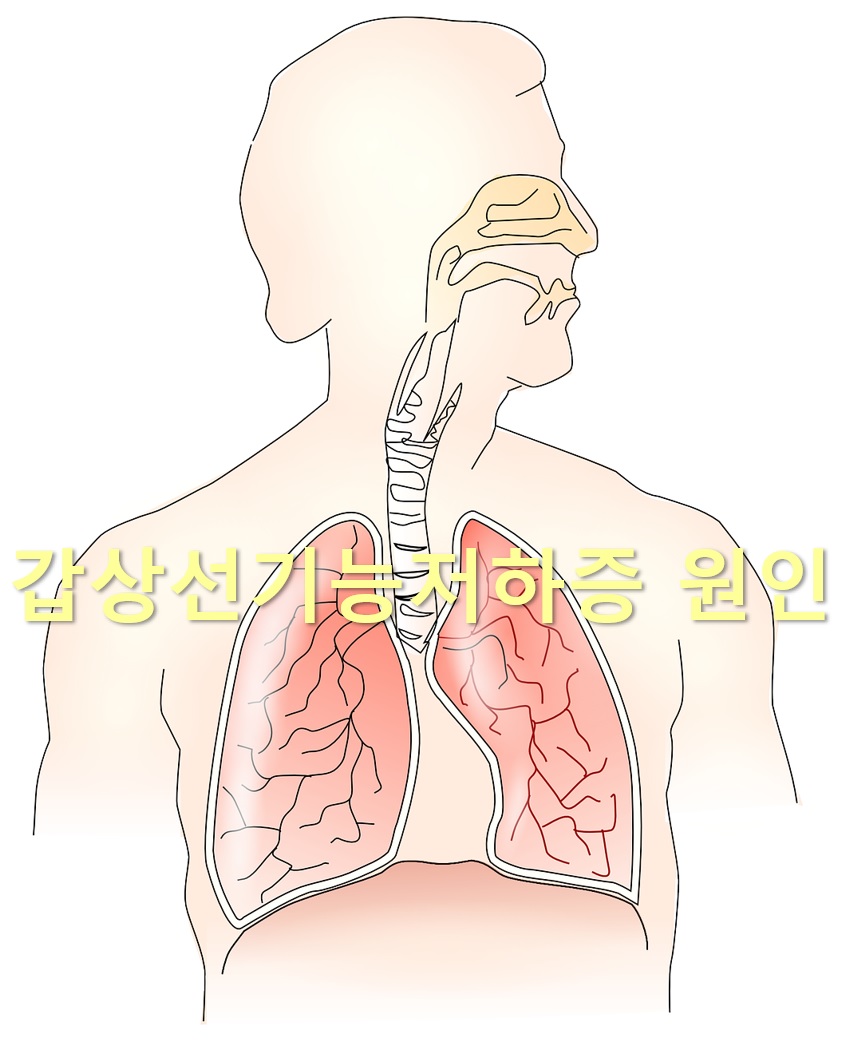  갑상선기능저하증 원인과 갑상선기능저하증 약 부작용