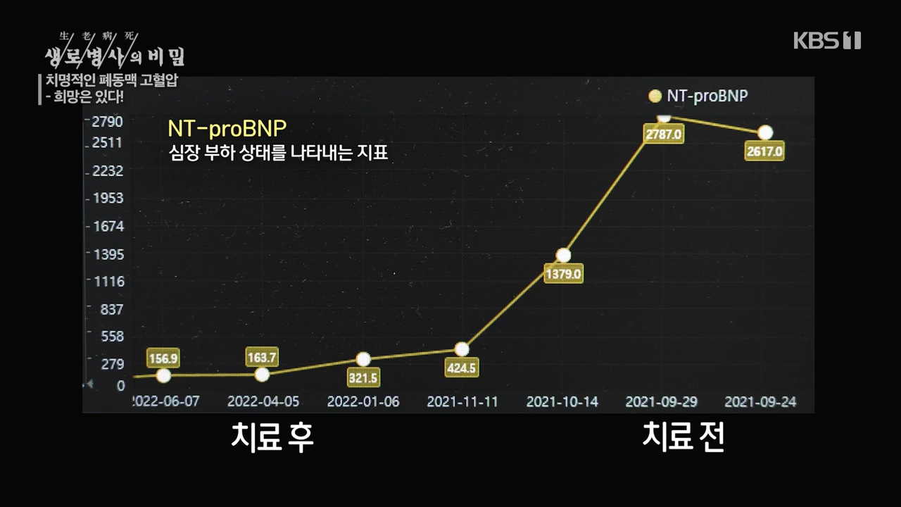 생로병사의 비밀.E900.240215p-NEXT.mp4_20240215_201749.146.jpg