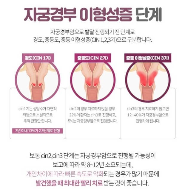 자궁경부이형성증 증상과 악화