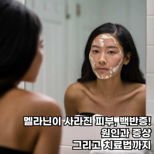 멜라닌이 사라진 피부, 백반증! 원인과 증상,