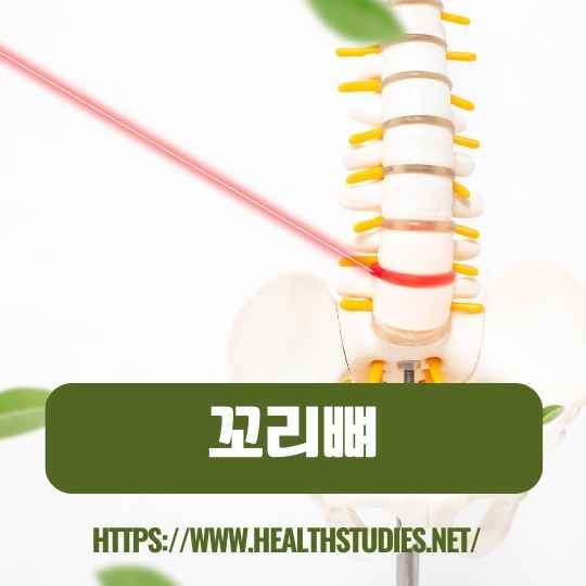 꼬리뼈 통증-사진-6