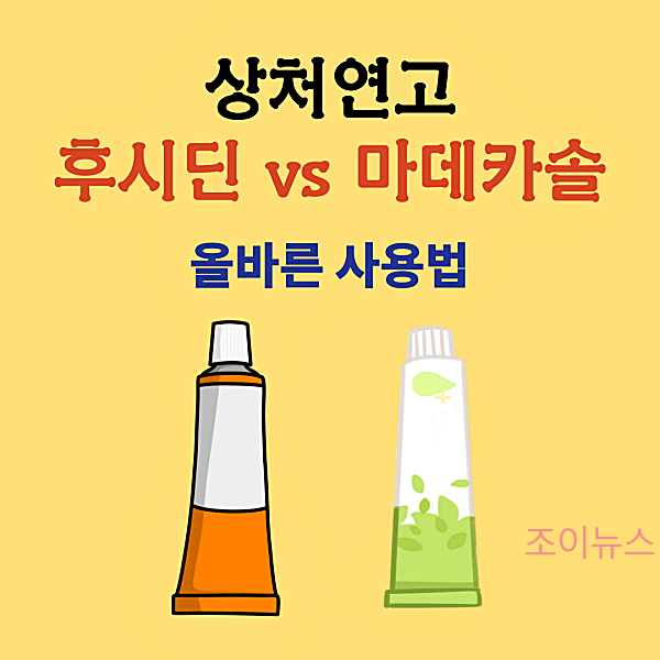 상처연고, 후시딘과 마데카솔! 올바른 사용법