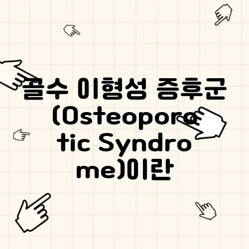 골수 이형성 증후군 (Osteoporotic Syndrome)이란