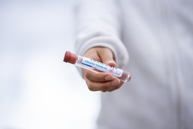 PCR 검사