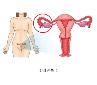 배란통 증상 및 시기 원인_1