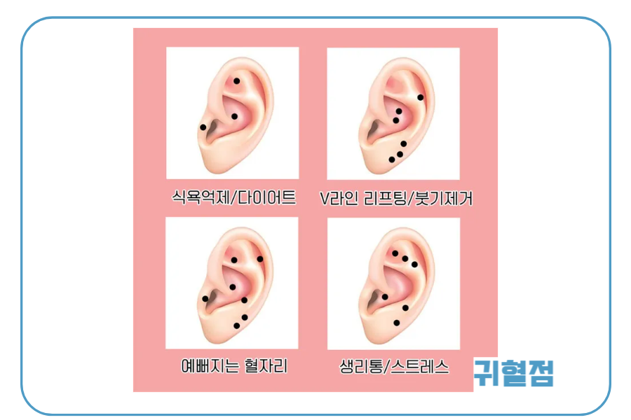 4가지 효능 귀혈자리 일러스트