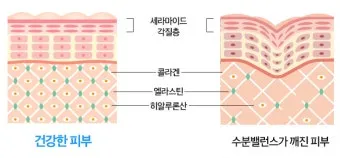 피부 구조와 기능 표피 진피 피하조직 위치 역할_20