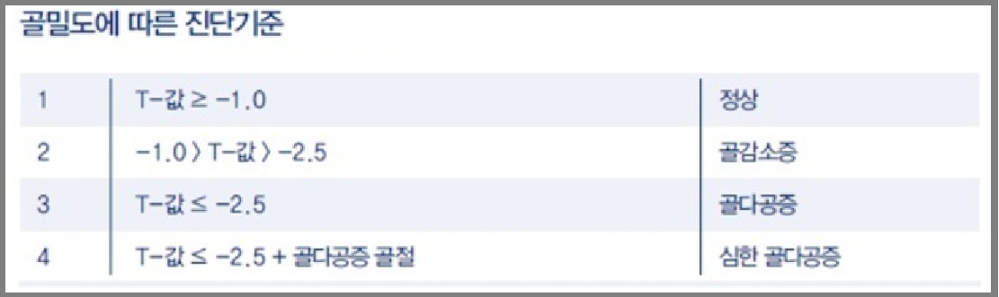 골다공증 진단기준