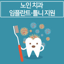 임플란트 가격