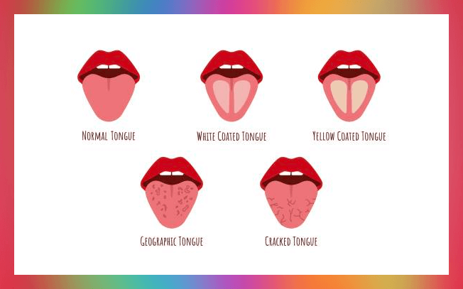혀와 관련 질환 종류 비교