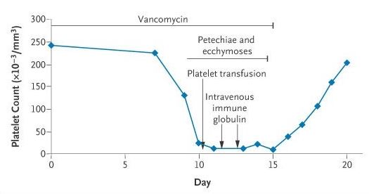 Vancomycin induced thrombocytopenia