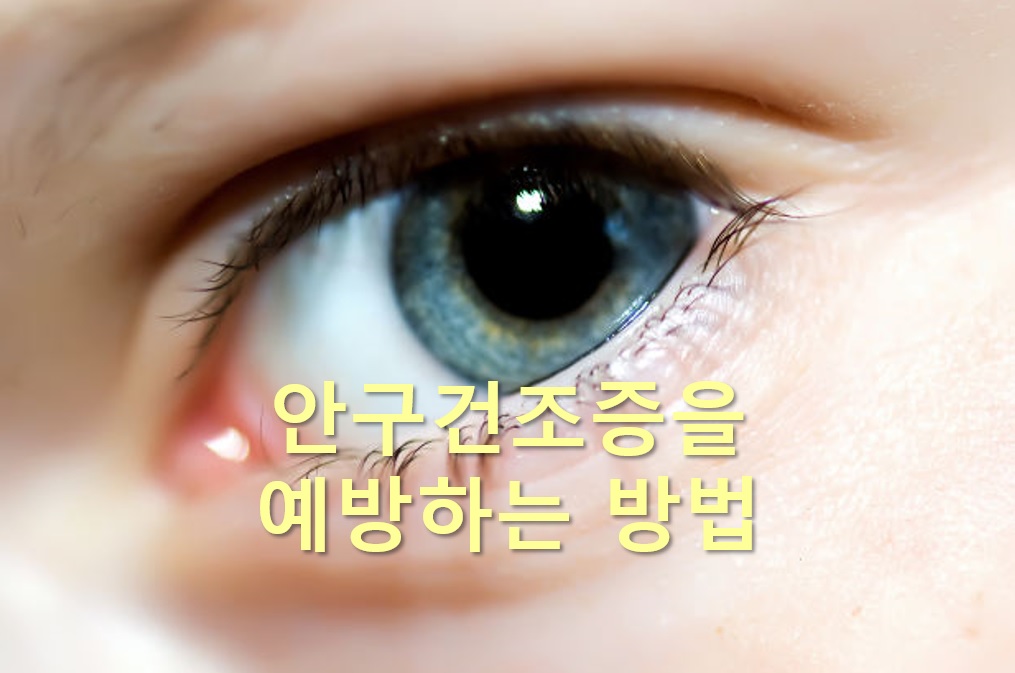  안구건조증을 완화하고 예방하는 방법